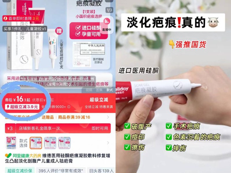 19元❗加赠3g一支维德⭐医疗凝胶祛疤膏15g小孩专用 适合宝宝娇嫩肌肤烫伤、摔伤、痘印都能祛除！-9/x2lZ43KK127// AA11